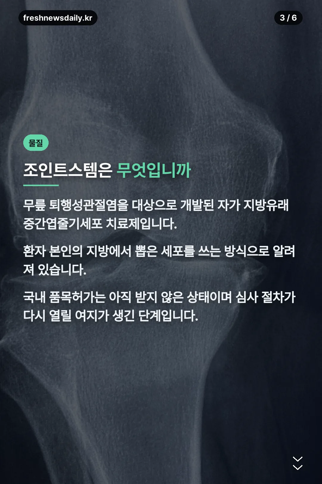 조인트스템 설명